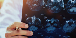 How refurbished MRI/CT Scanners can help in the global fight against cancer